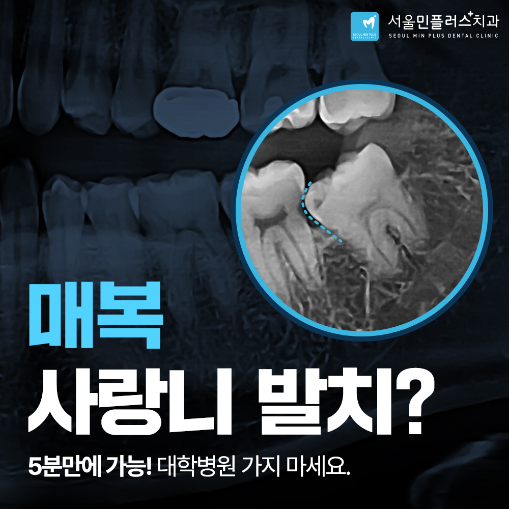 서울민플러스치과의원 대표 이미지