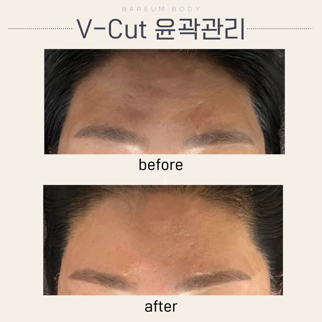 바름바디케어