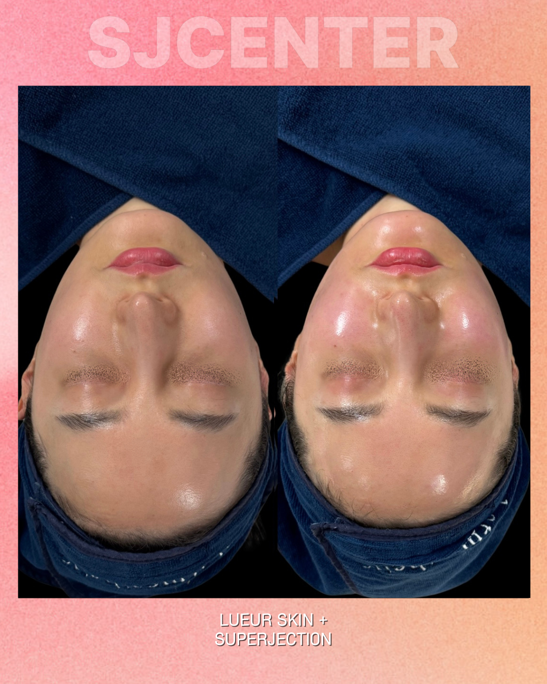 뤼에르스킨 왕십리본점 대표 이미지