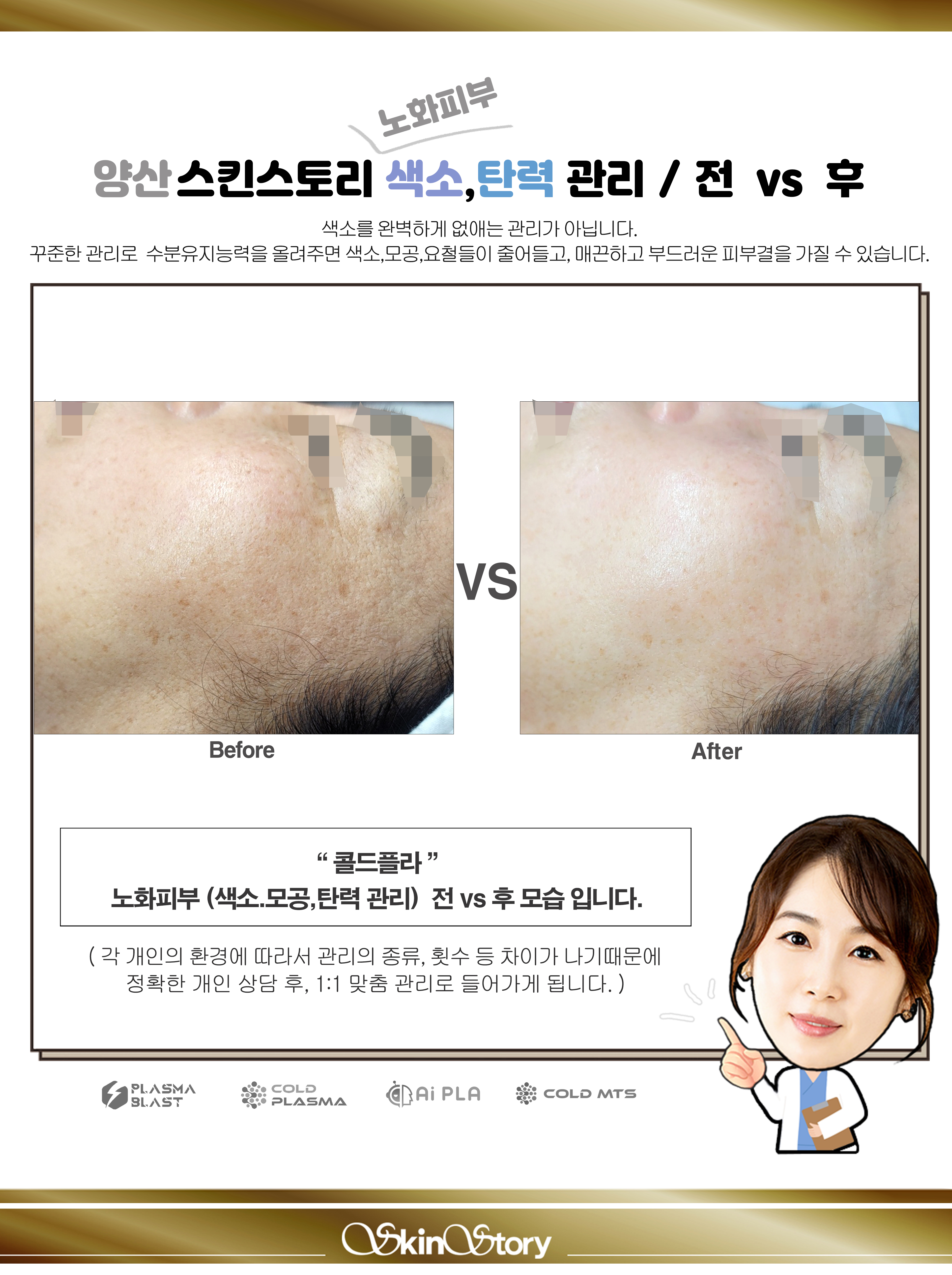 스킨스토리