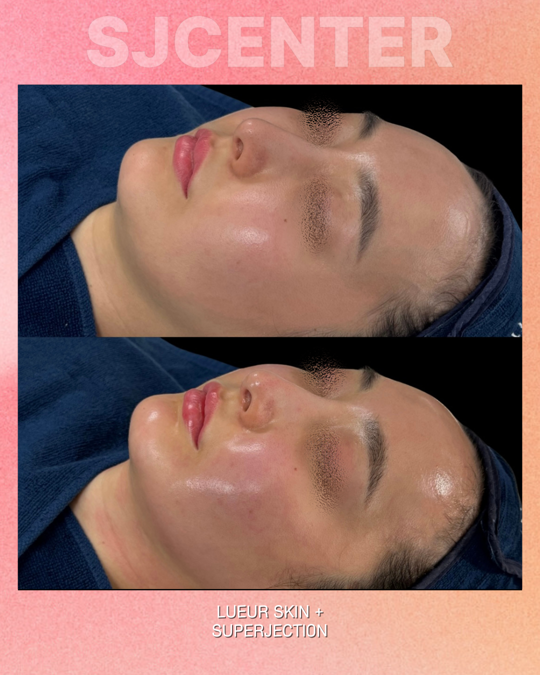 뤼에르스킨 왕십리본점 대표 이미지