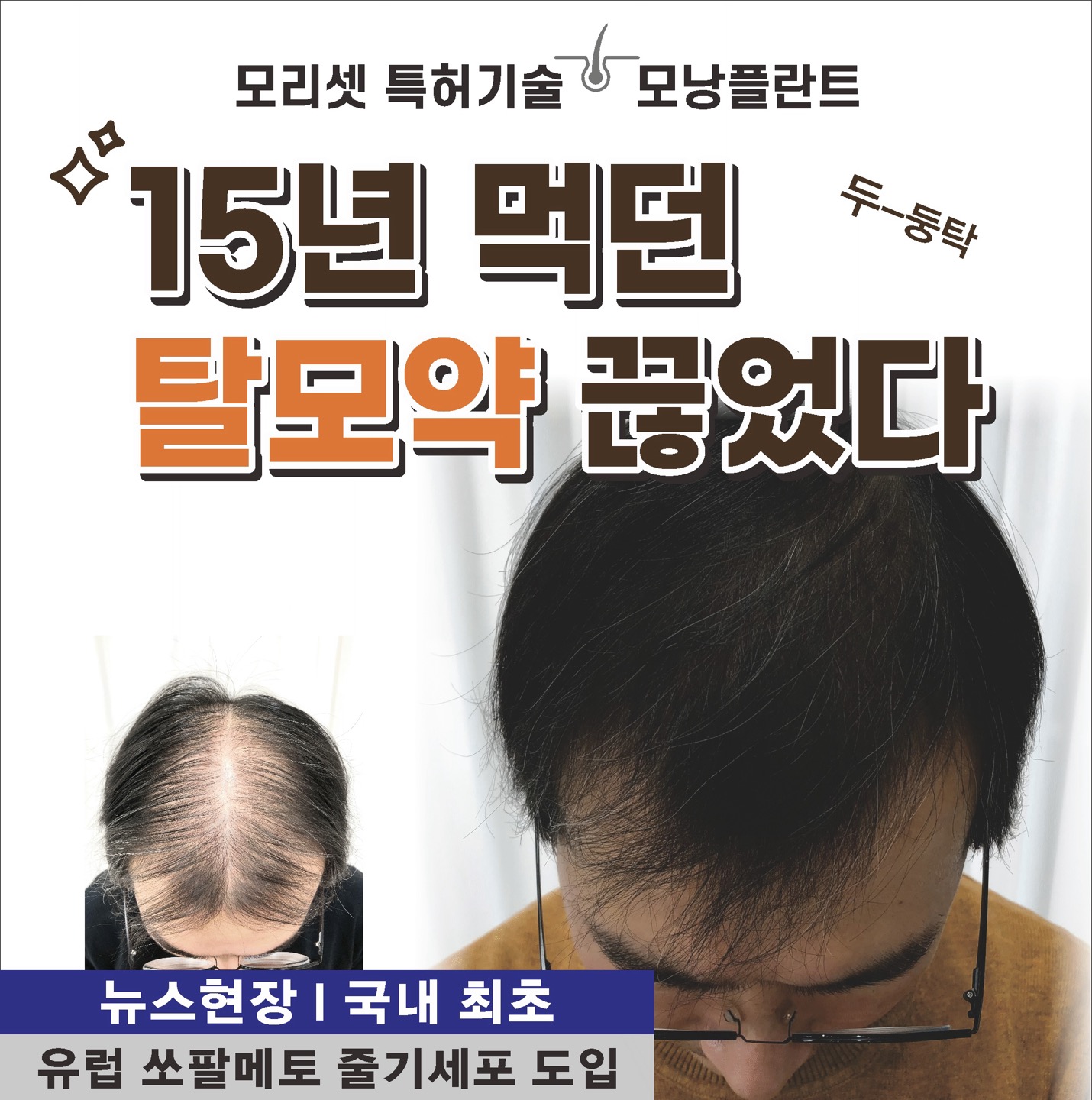 모리셋두피재생센터 울산점 대표 이미지