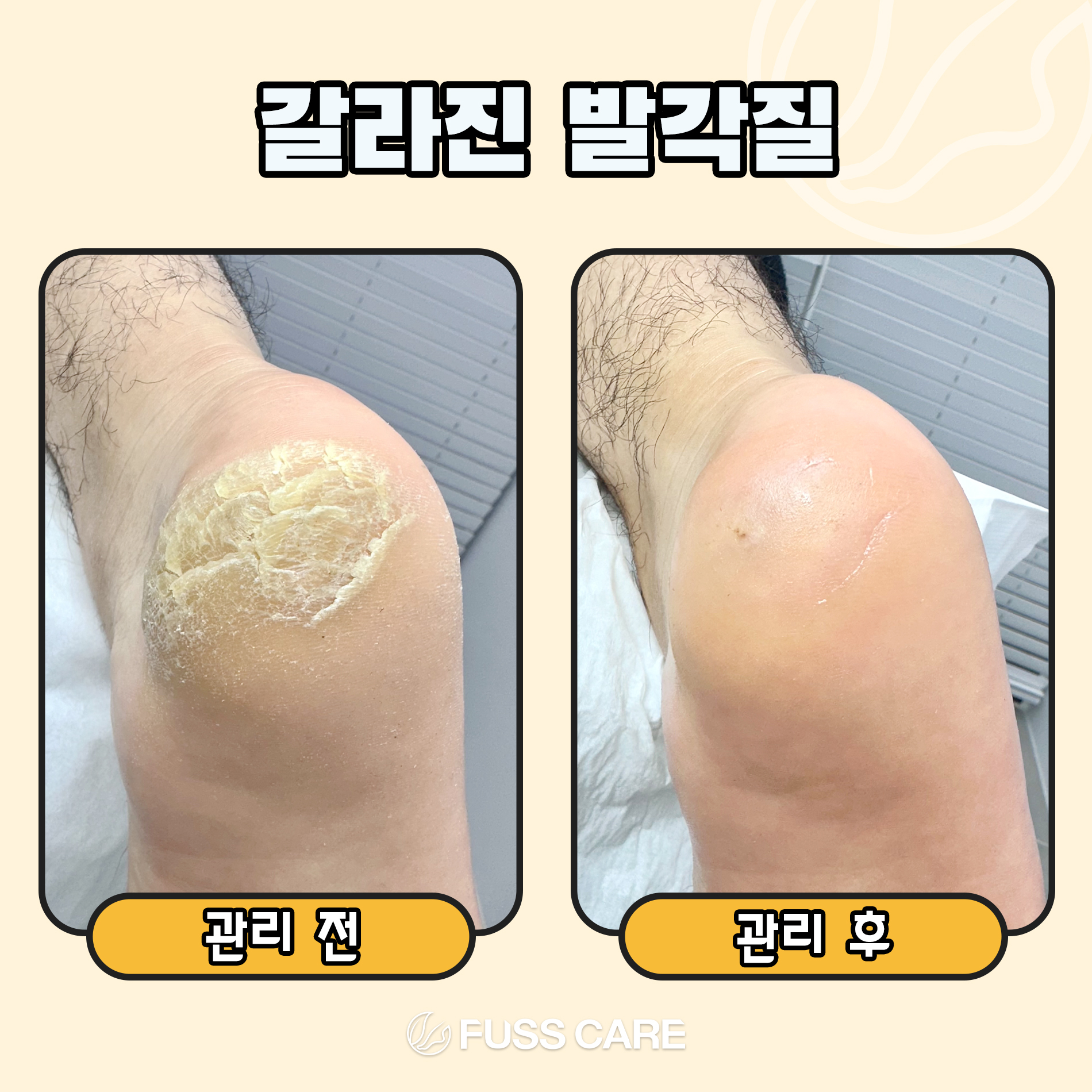 푸스케어 평택비전점