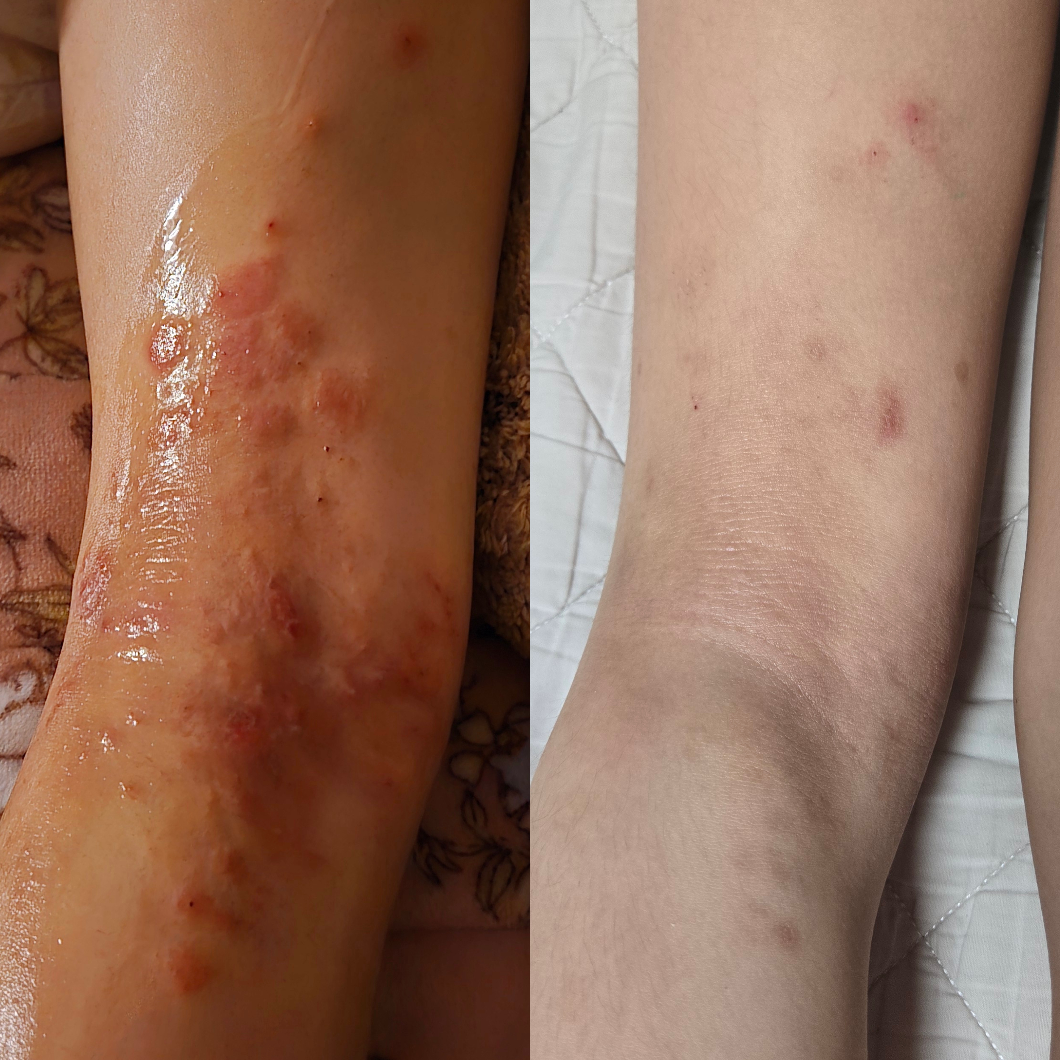 올림스킨멘토 강릉점 대표 이미지