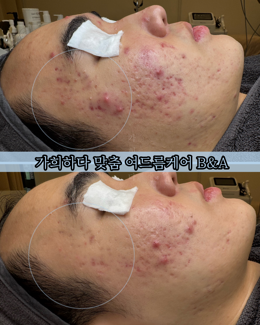 가희하다 잠실 대표 이미지