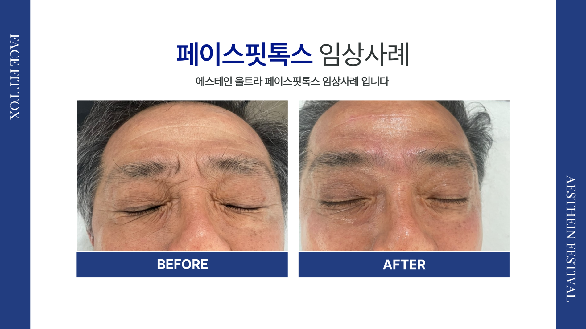 이수피부관리 키미스킨앤뷰티/스킨플래닝