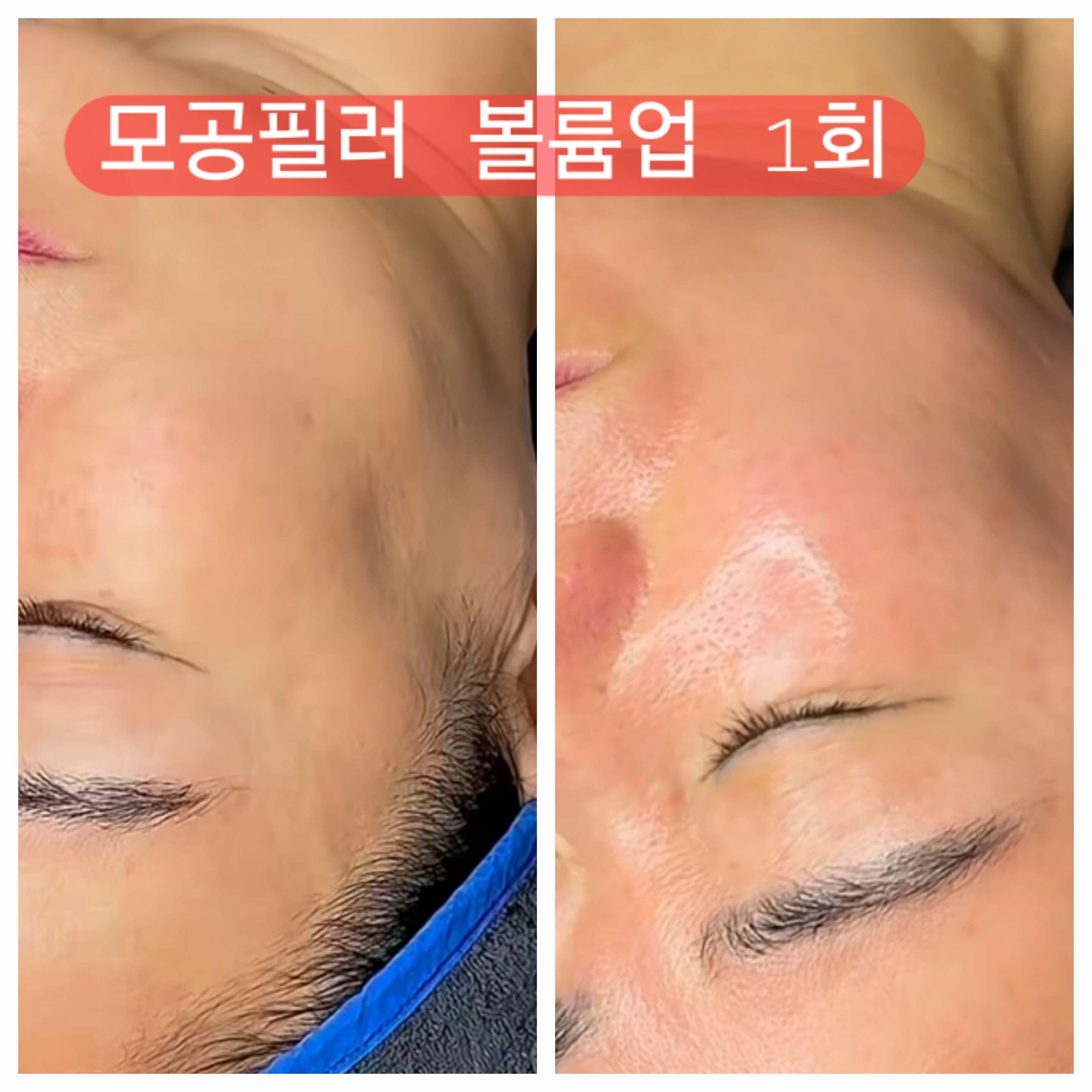 올뷰티yoons 대표 이미지