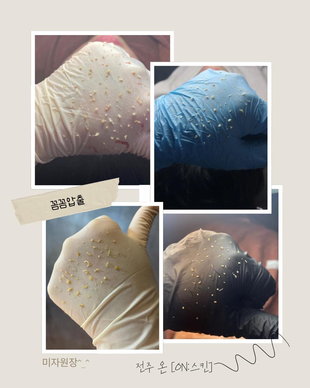 온스킨