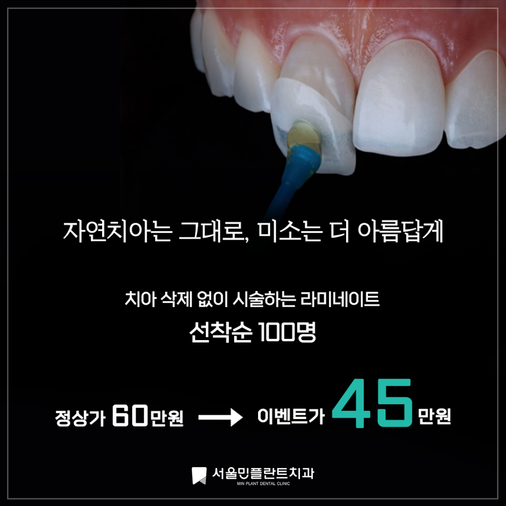 서울민플란트치과의원 성남 대표 메뉴