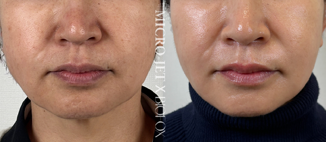 꼬모 왁싱&뷰티 대표 이미지