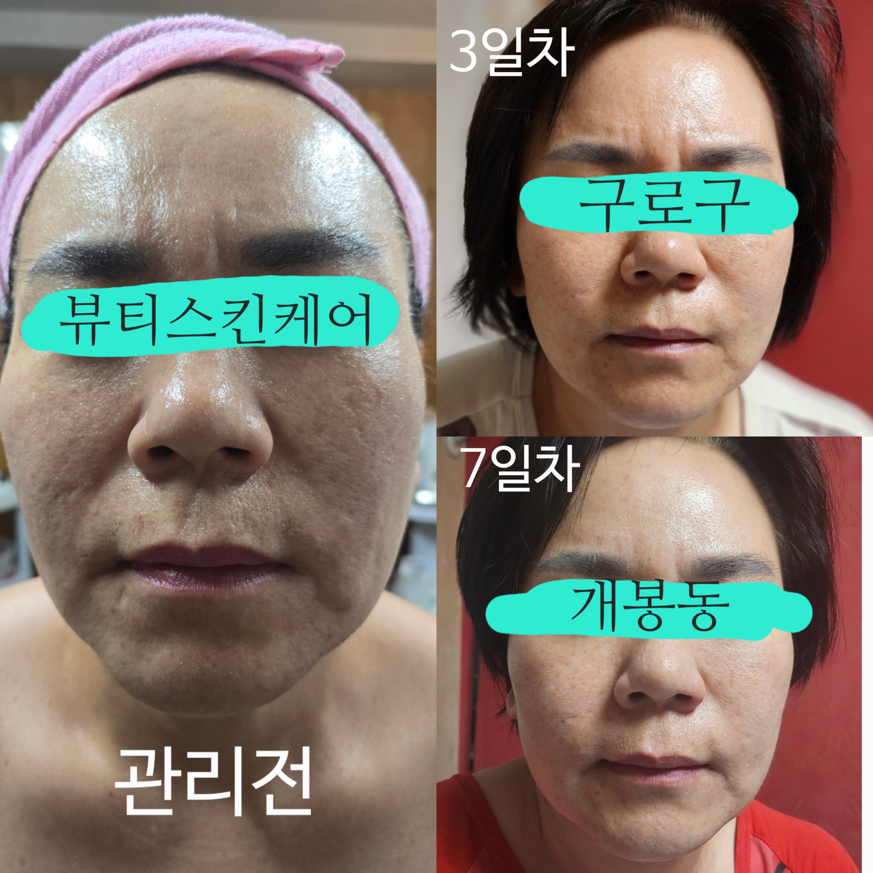 뷰티스킨케어 개봉동본점 대표 이미지