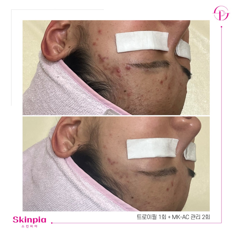 스킨피아 대표 이미지