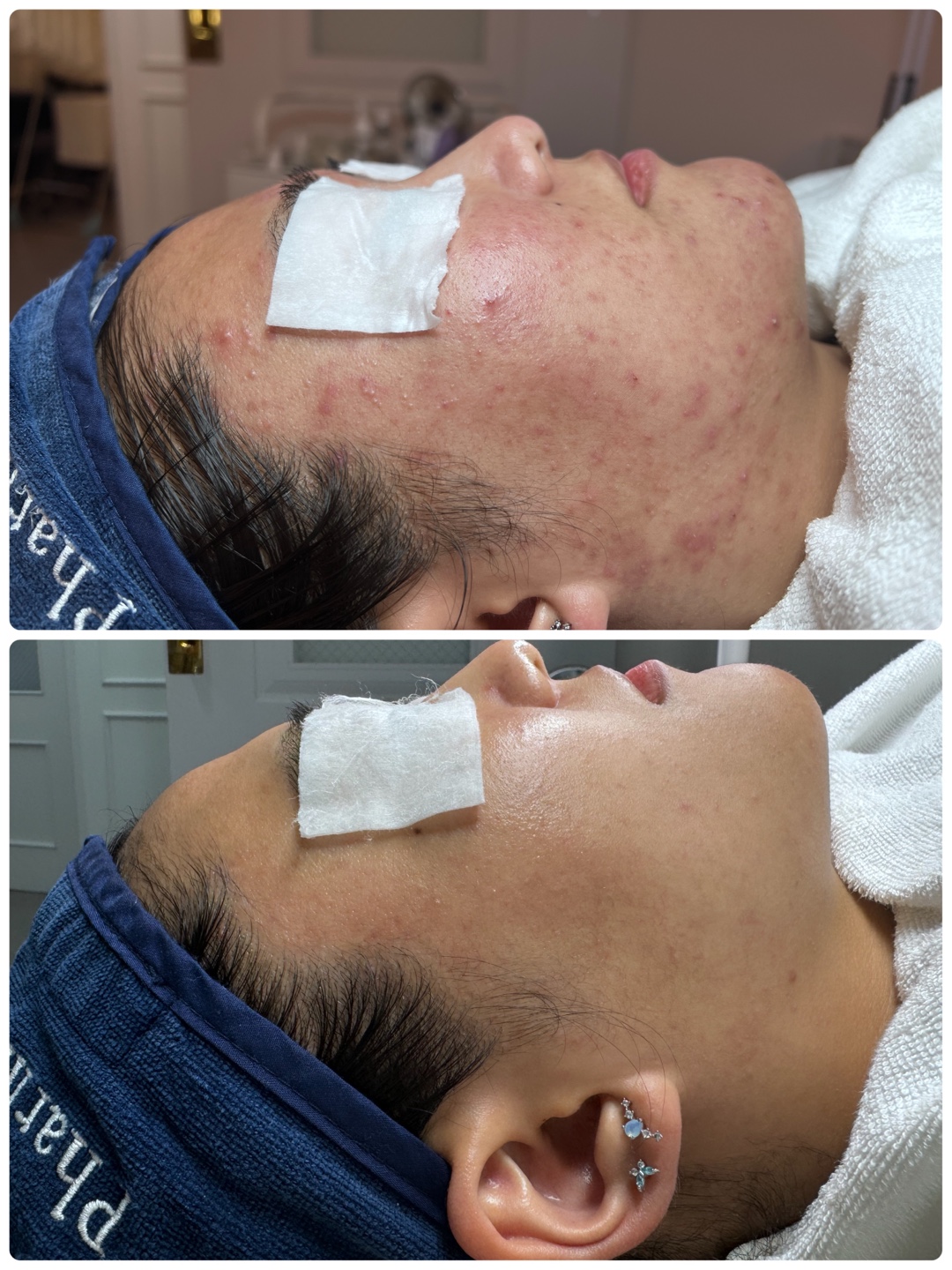 정원장의 모공세척테라피 대표 이미지
