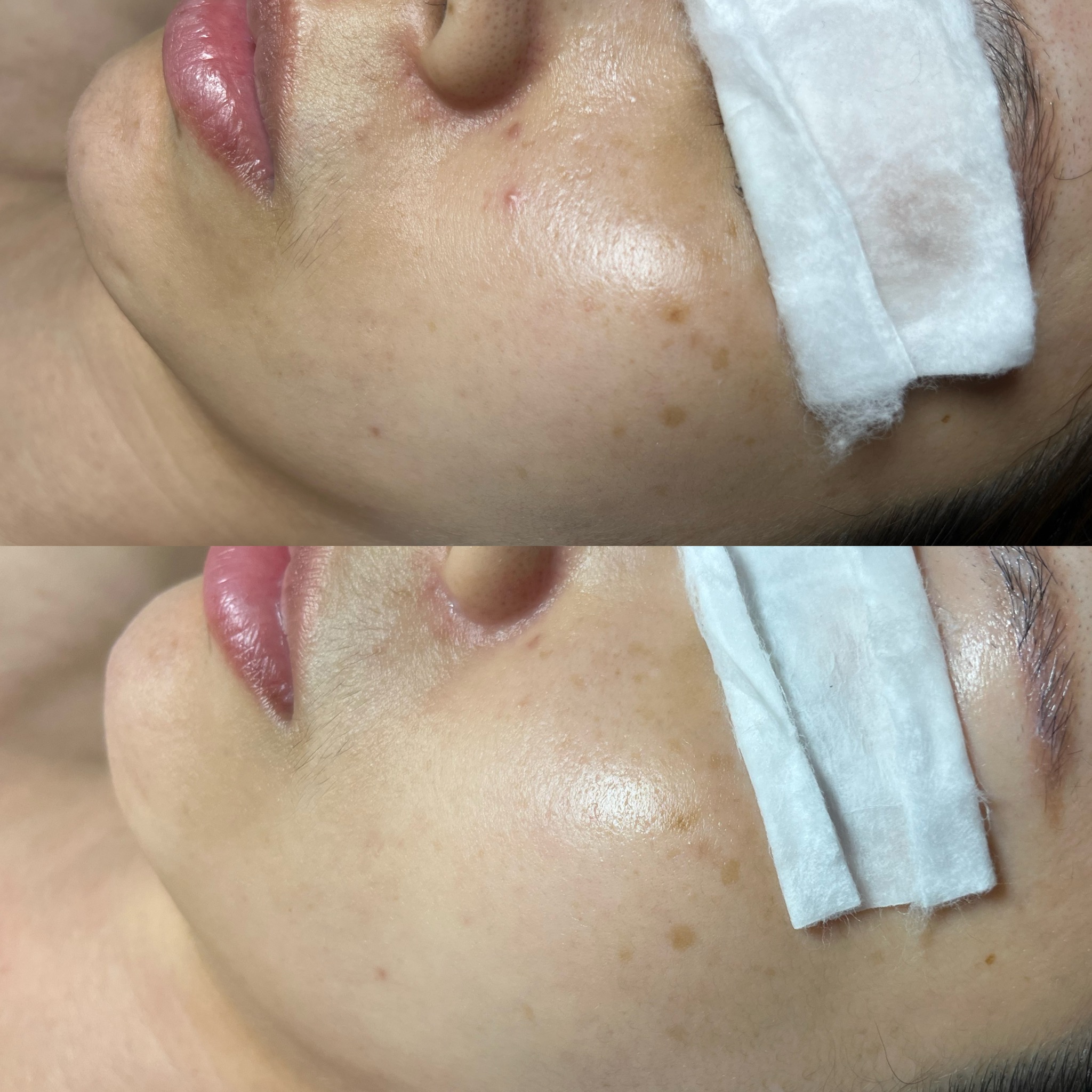 디안스킨 대표 이미지