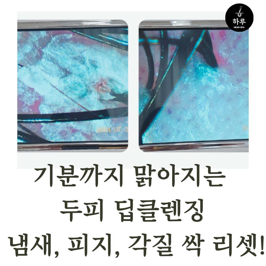 하루헤드스파 대표 이미지