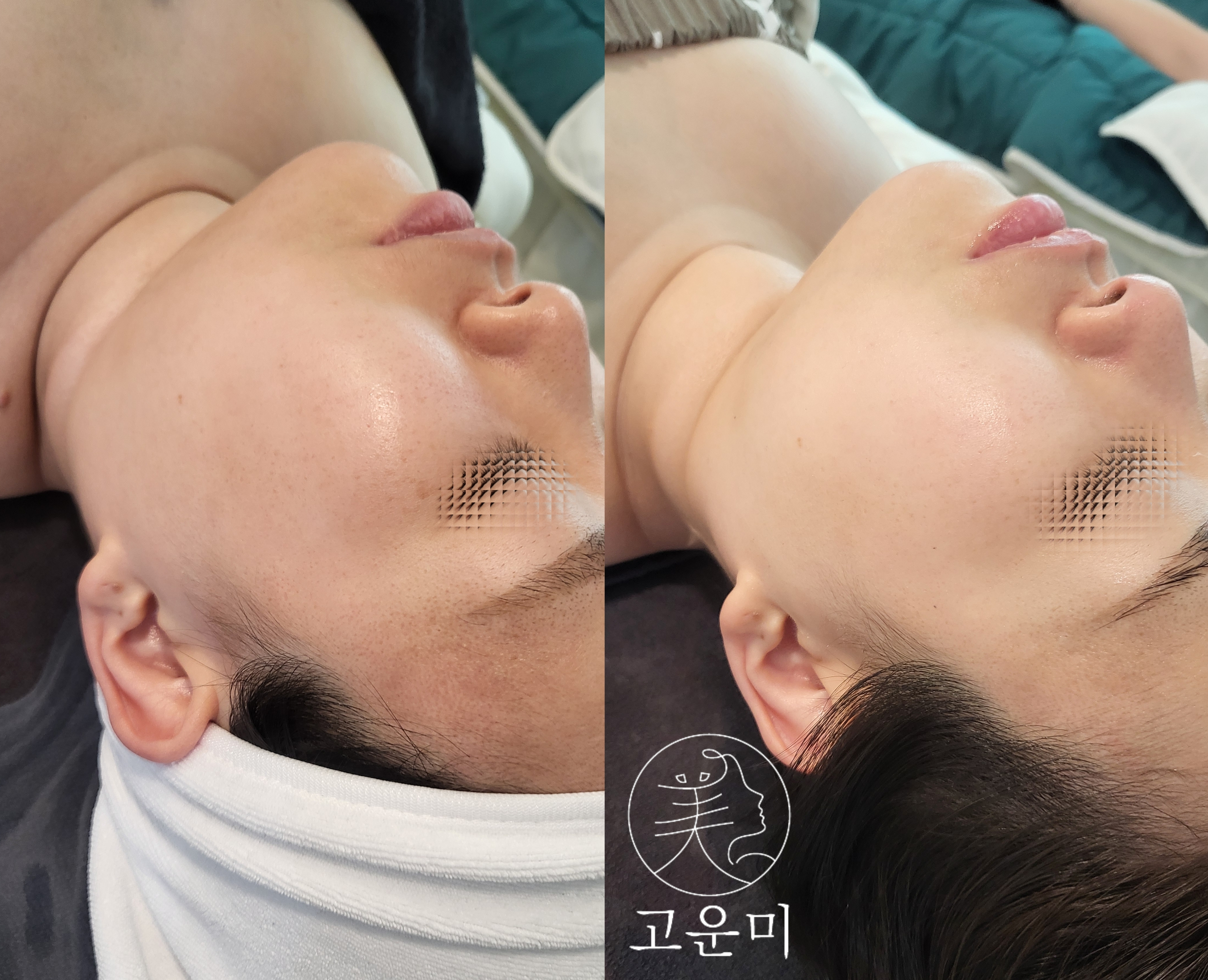 고운미에스테틱 대표 이미지