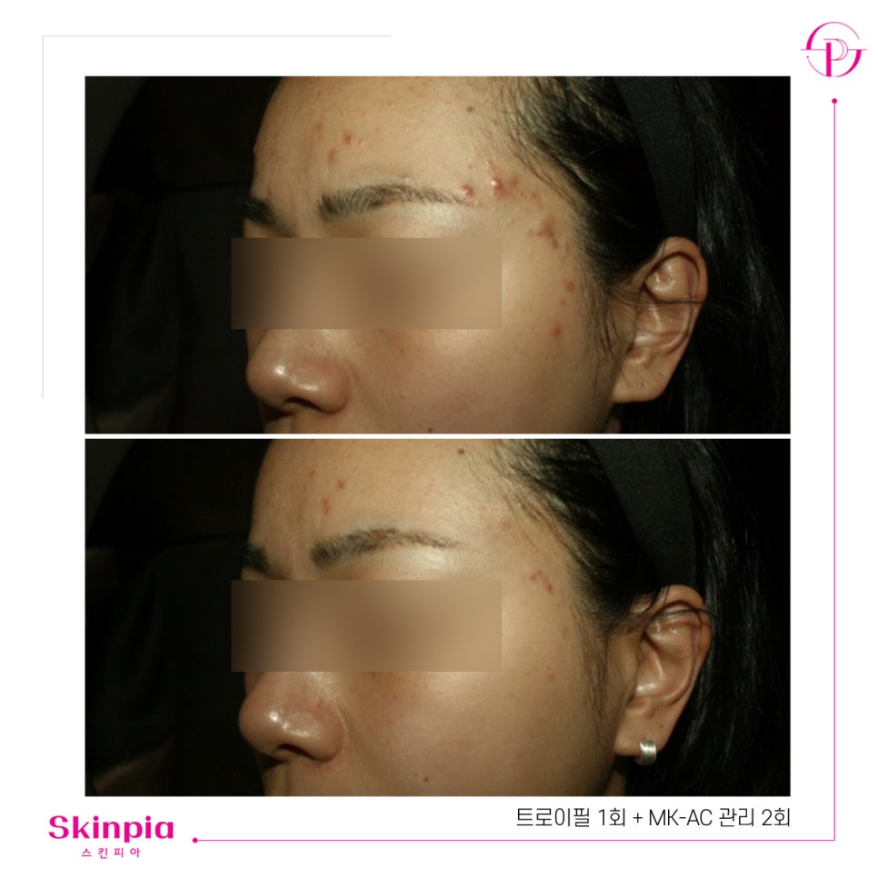 스킨피아 대표 이미지
