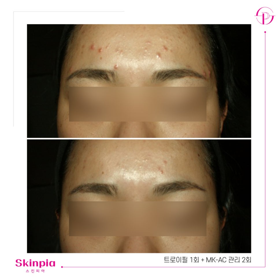 스킨피아 대표 이미지