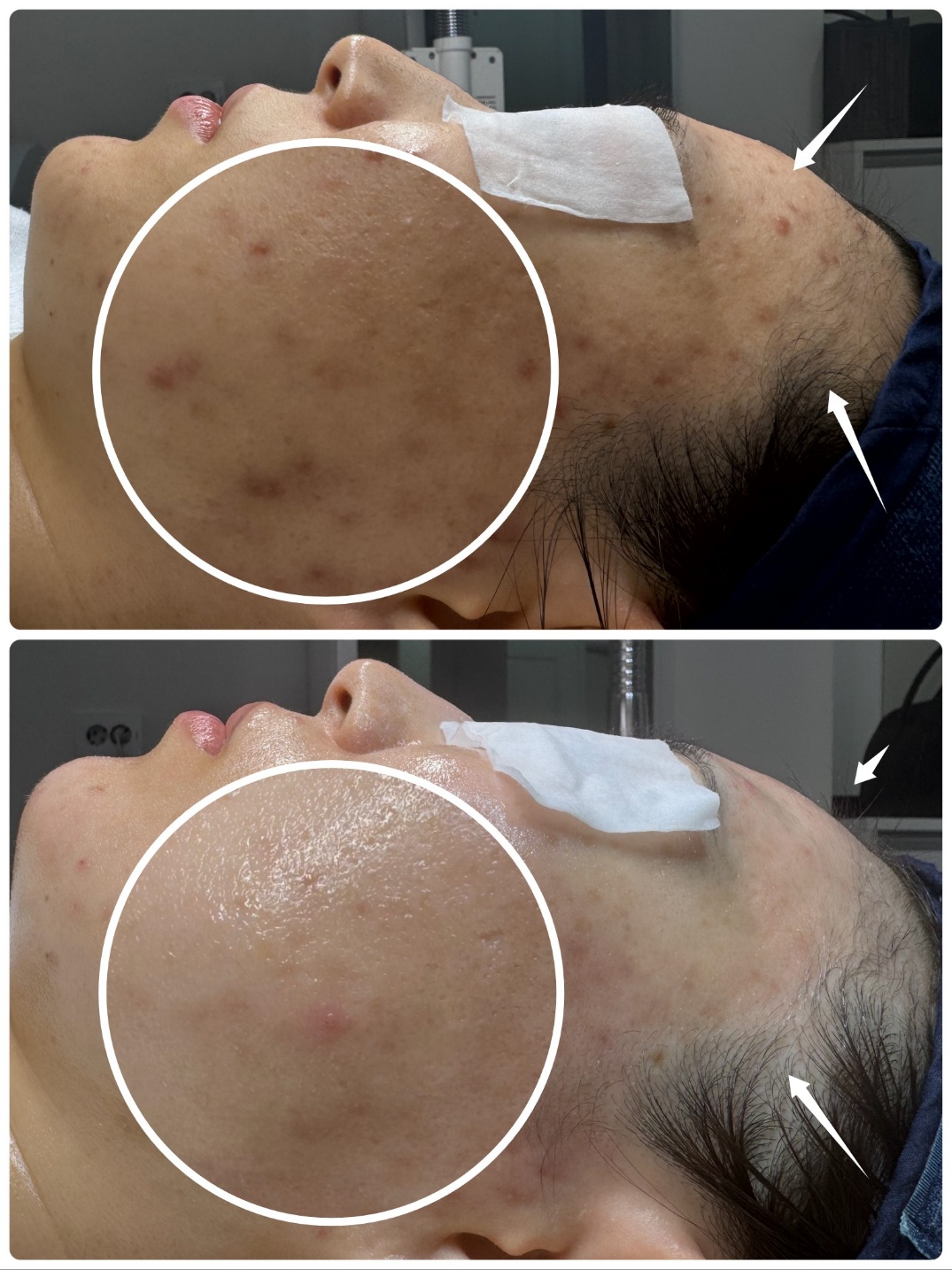 정원장의 모공세척테라피 대표 이미지