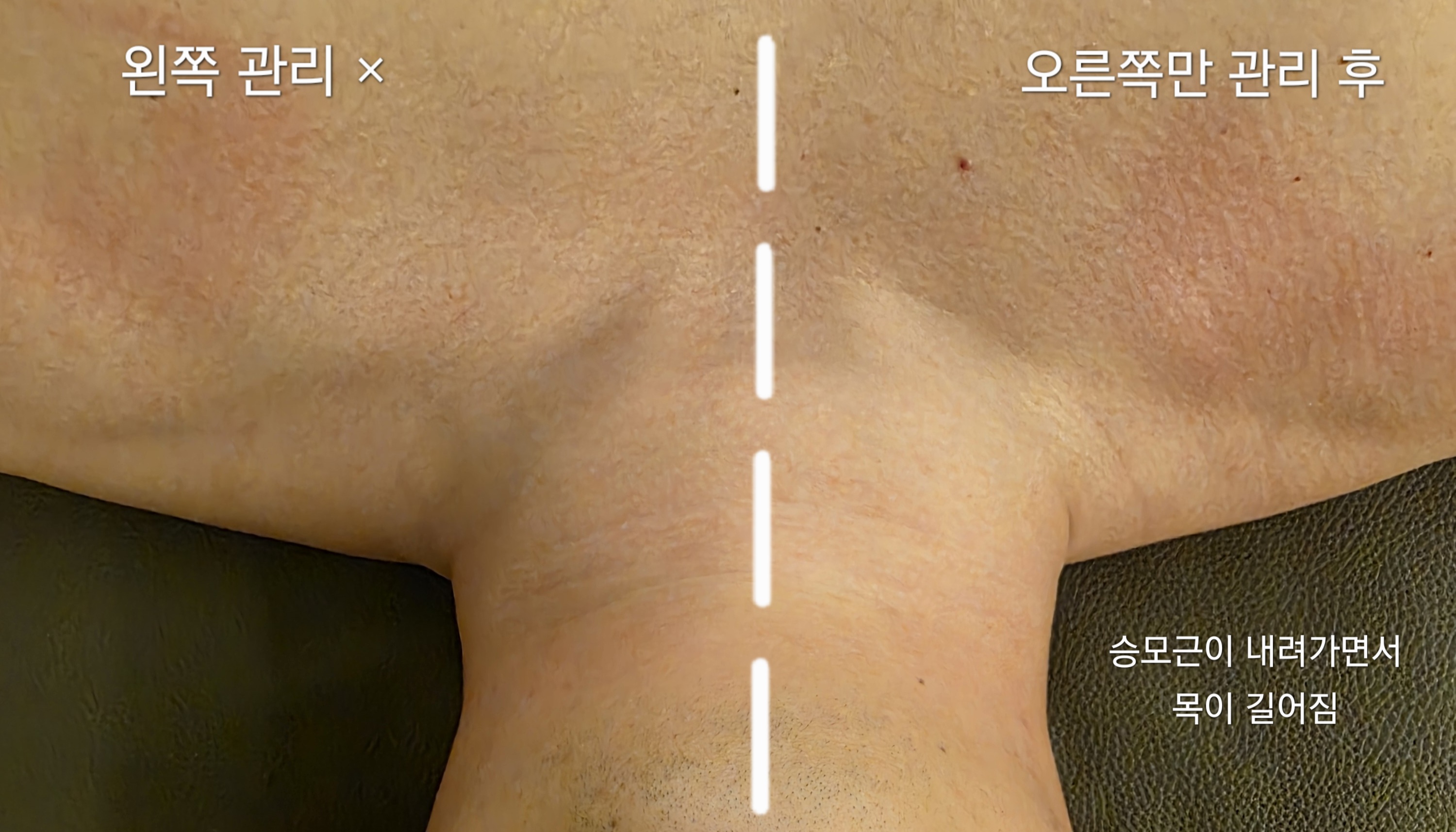 테라피타임 photo 7