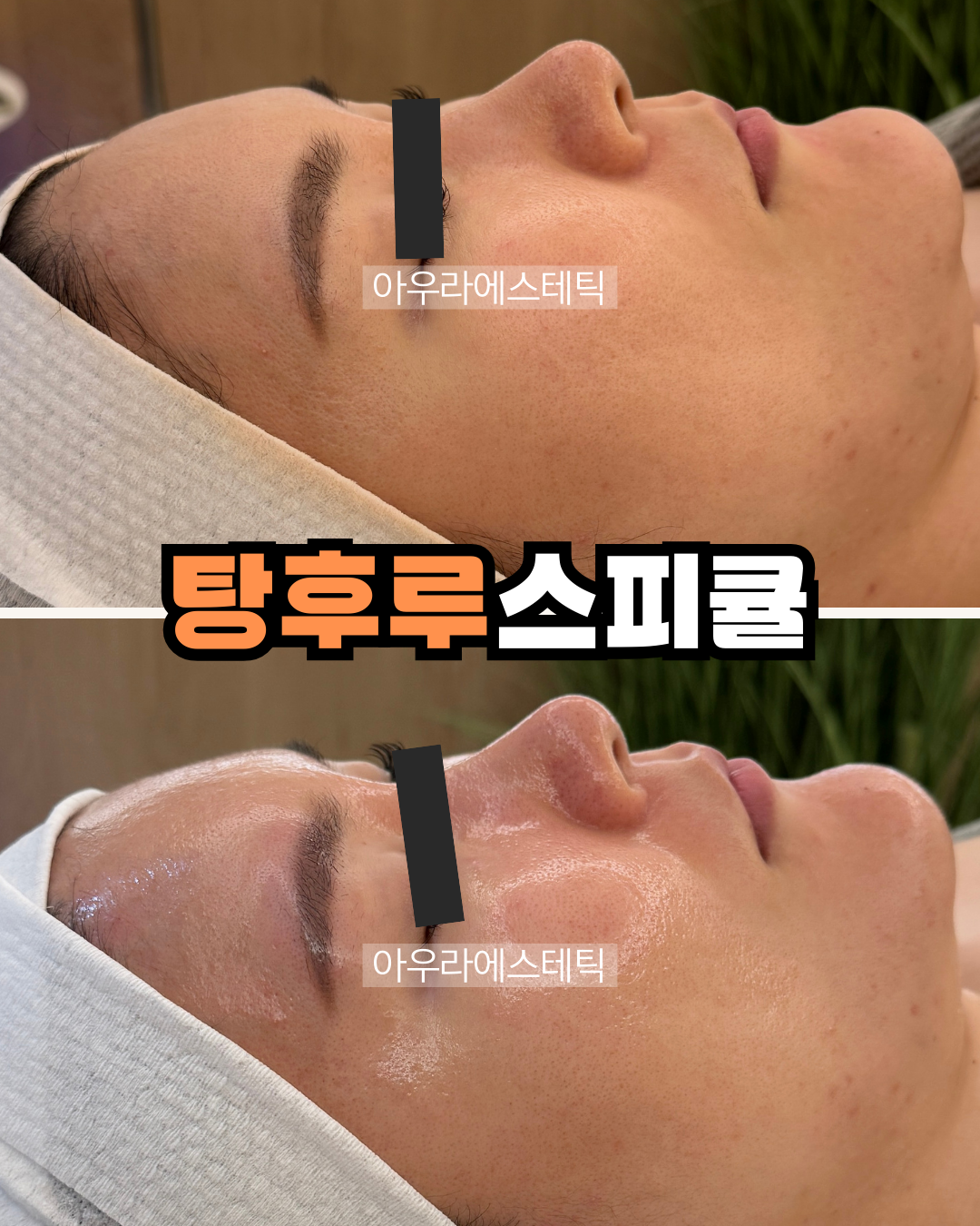 아우라에스테틱 김해삼계점