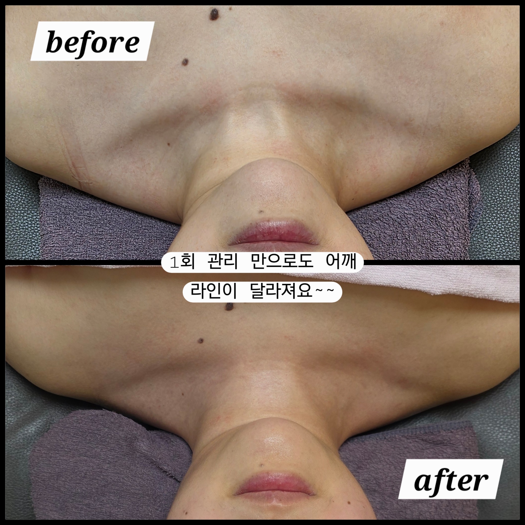 테라피타임 photo 5