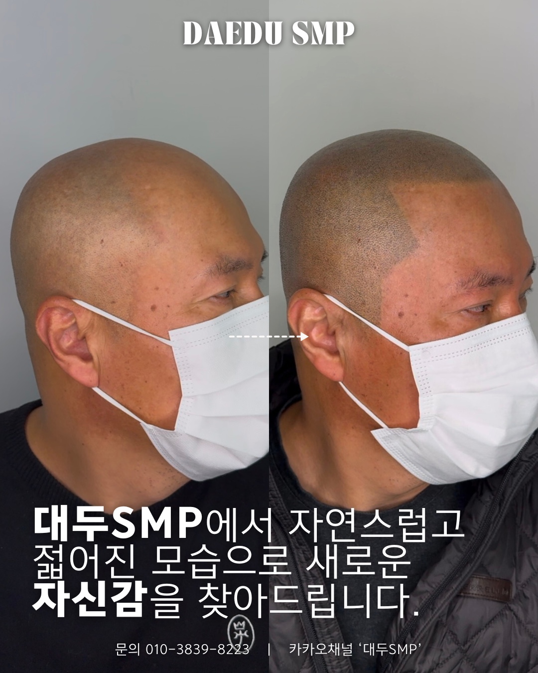 대두SMP 대표 이미지