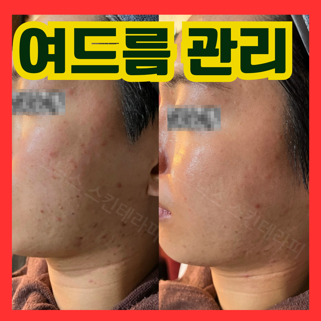 오닉스 스킨테라피 대표 이미지