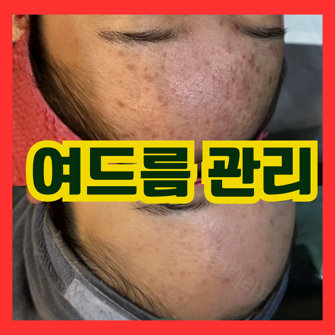 오닉스 스킨테라피 대표 이미지