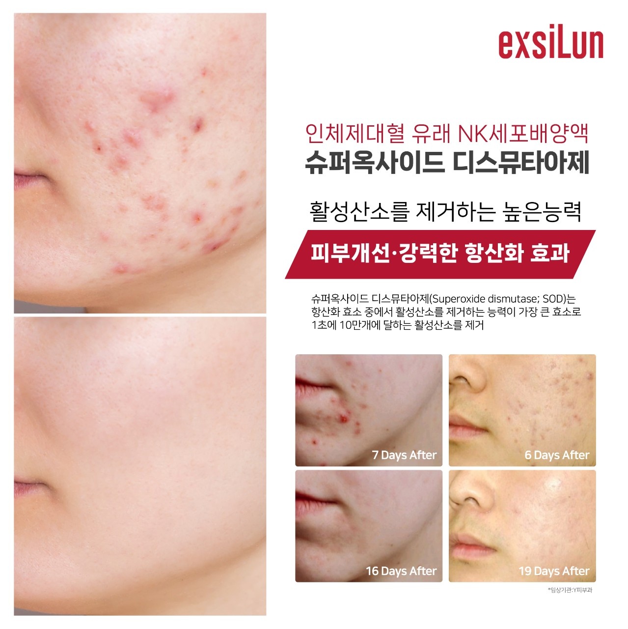 뷰티인펄 대표 이미지