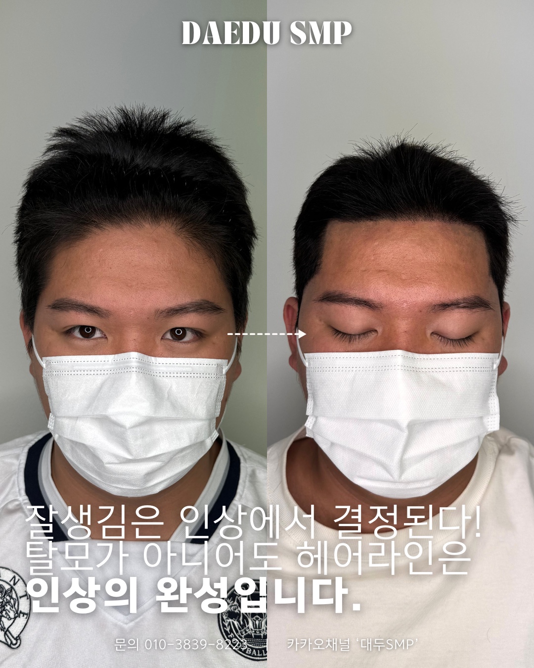 대두SMP 대표 이미지