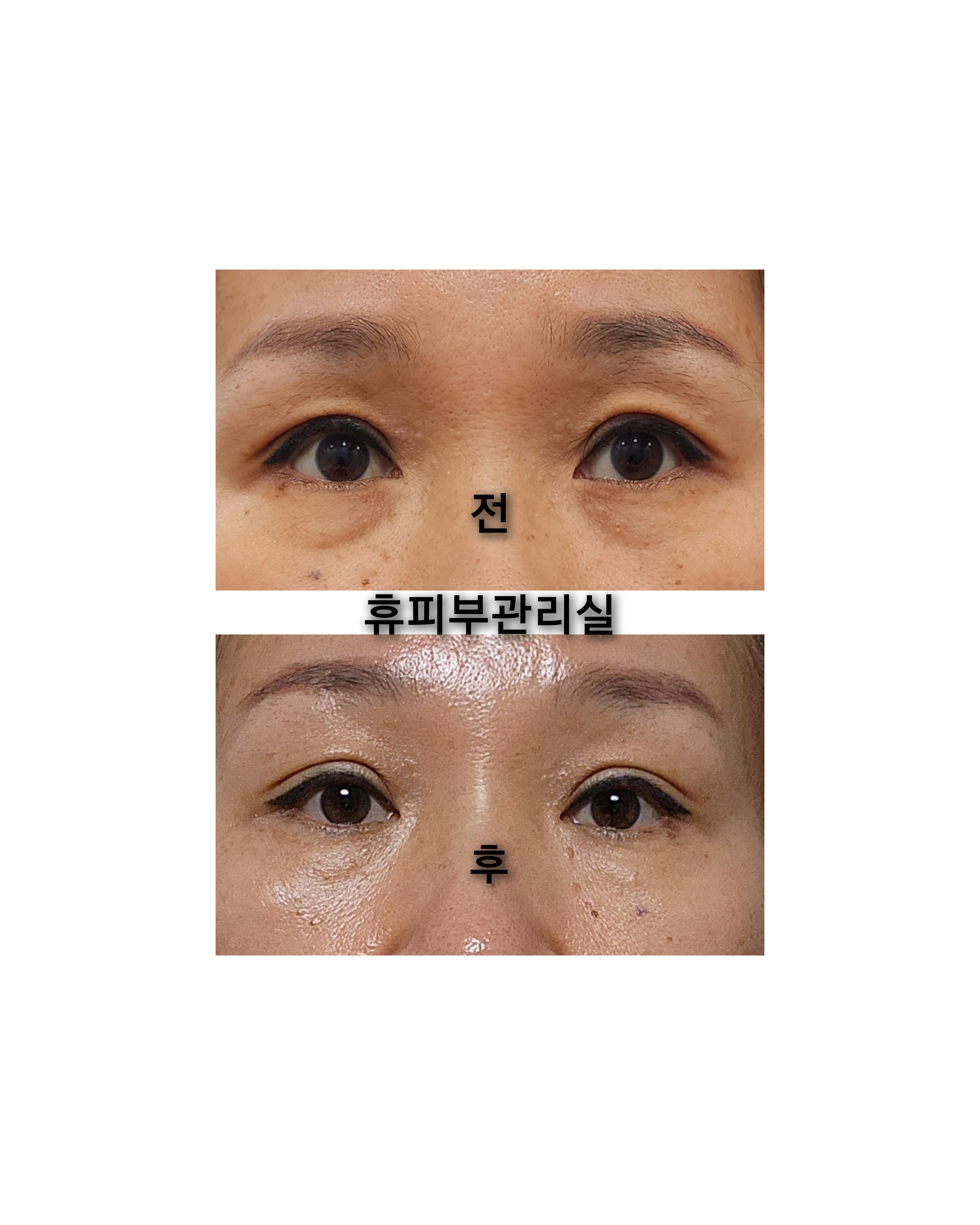 휴피부관리실