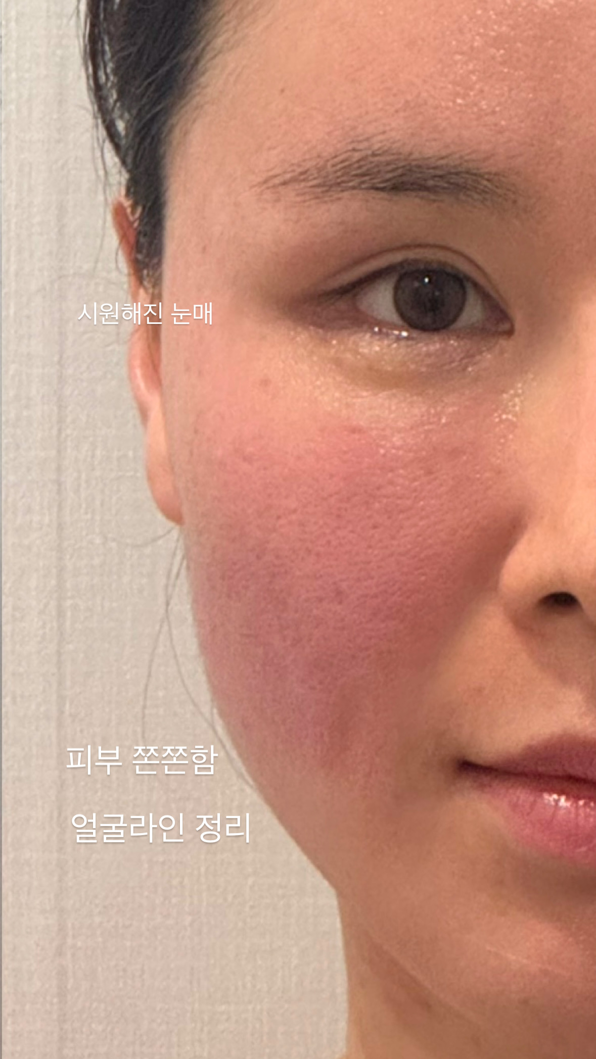 오르멜라 뷰티에스테틱 강남본점
