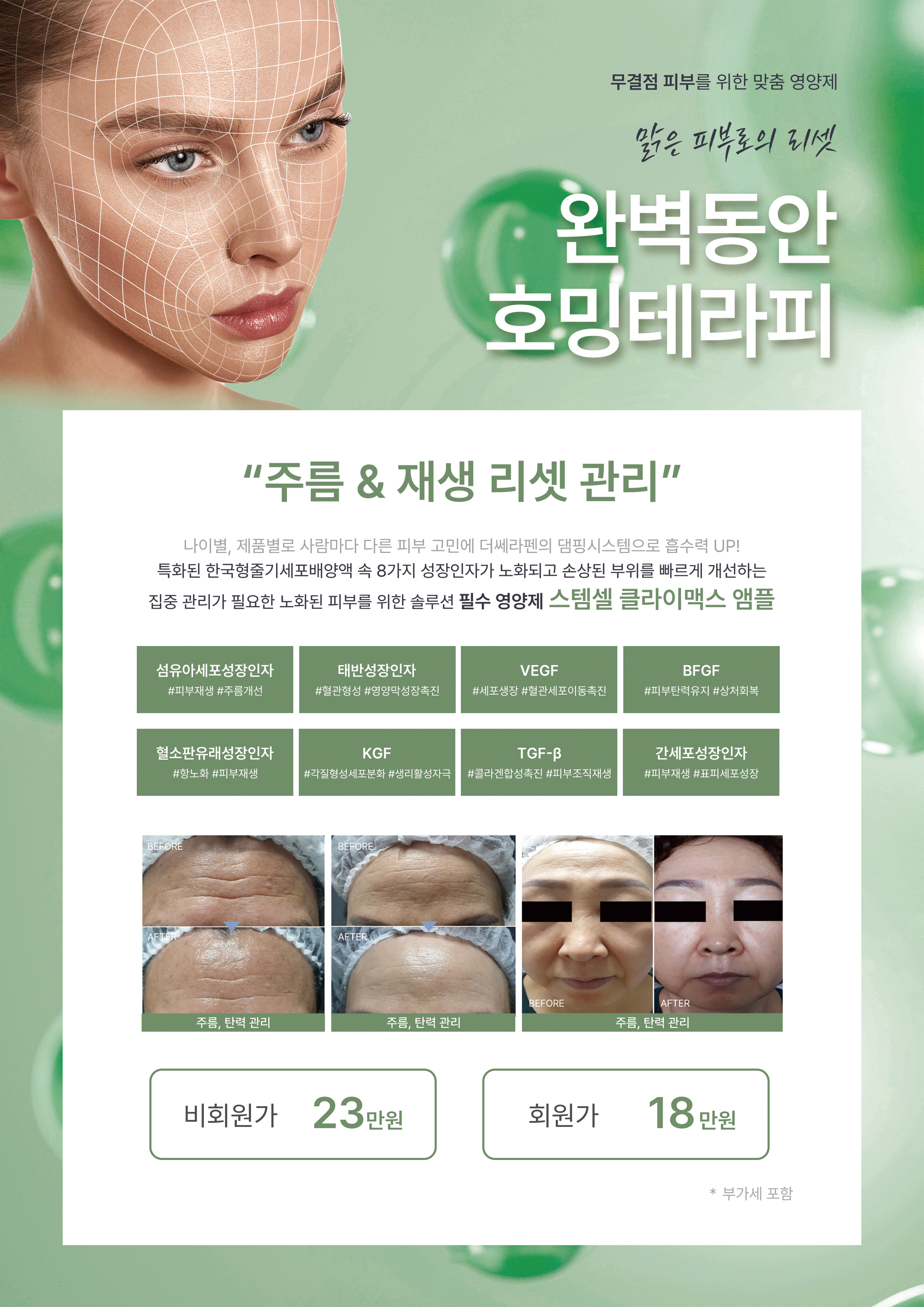 휴에스테틱