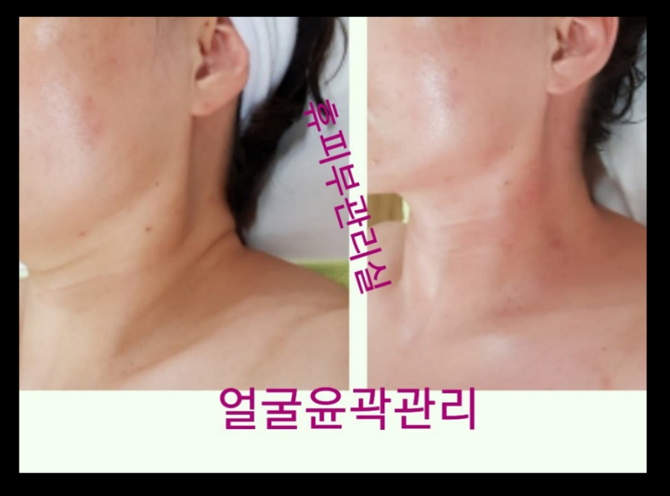 휴피부관리실