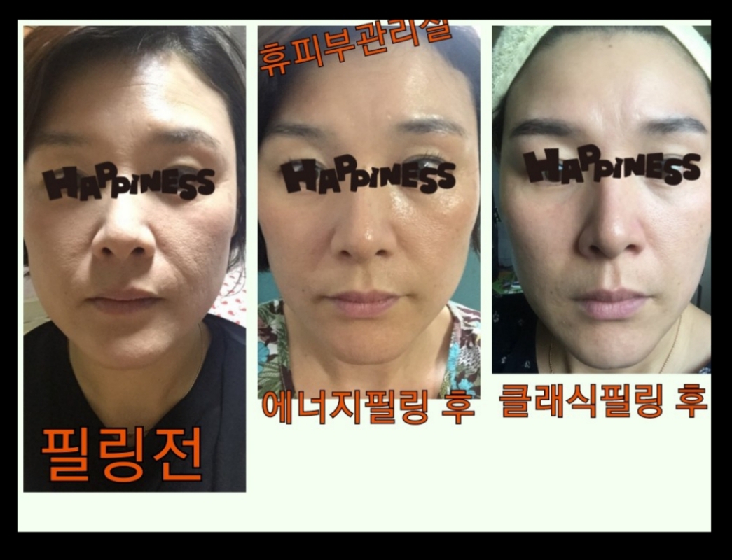 휴피부관리실