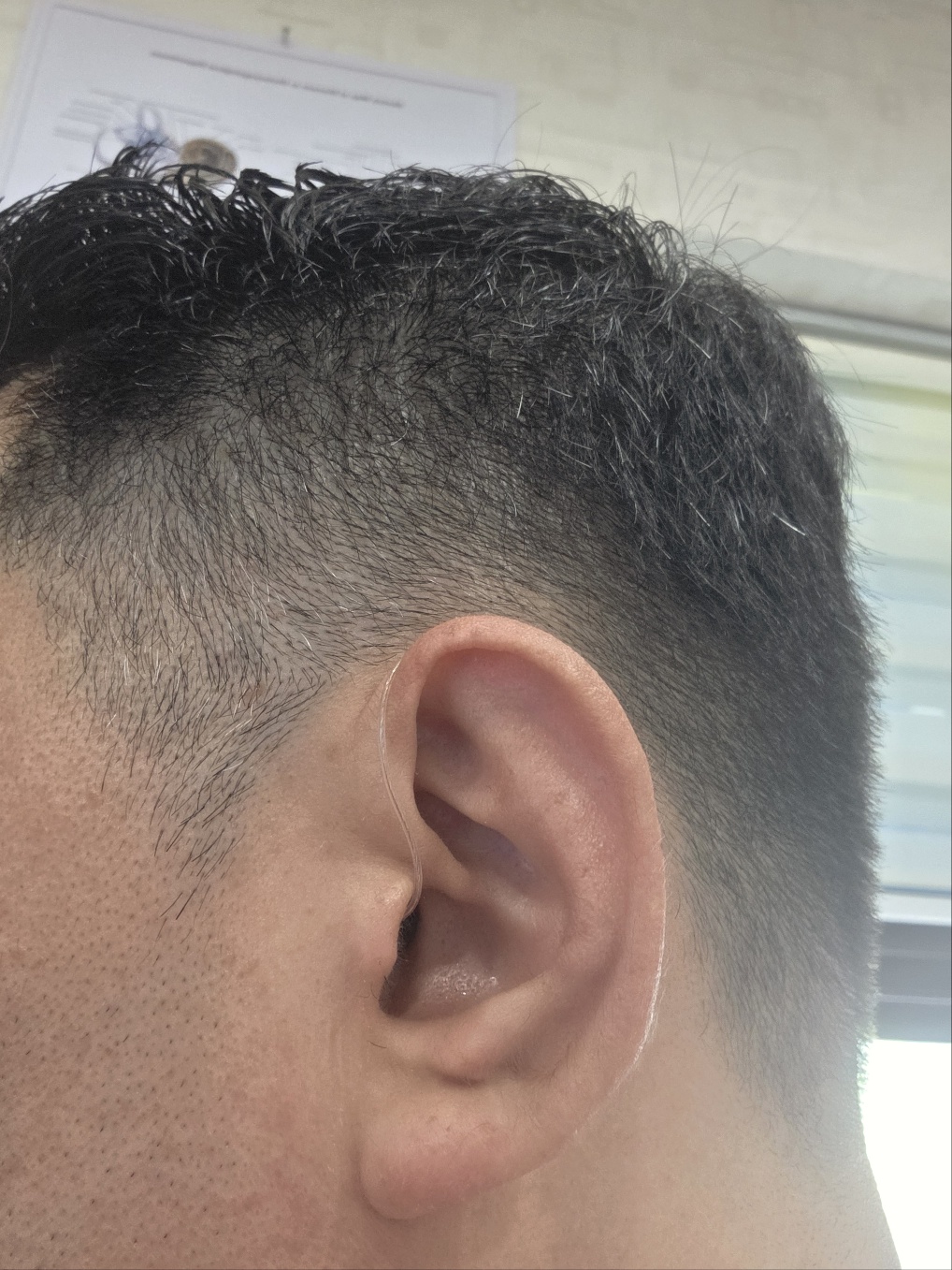 평촌덴마크보청기 안양점 대표 이미지