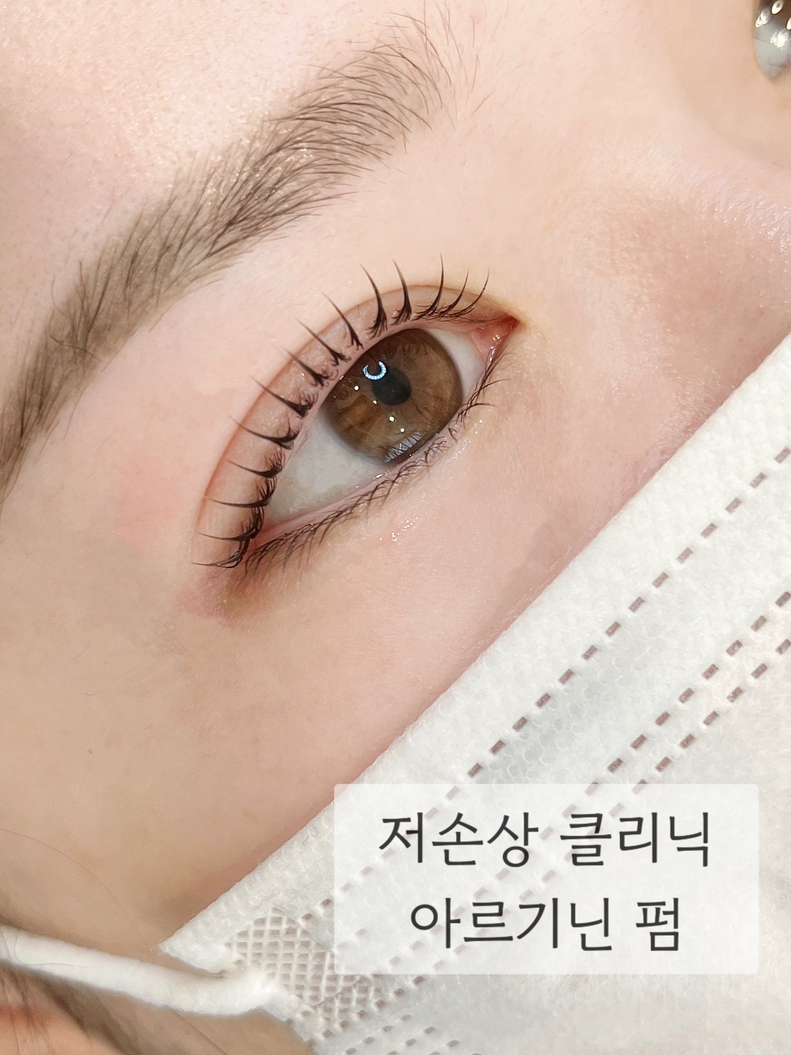 아끌래쉬