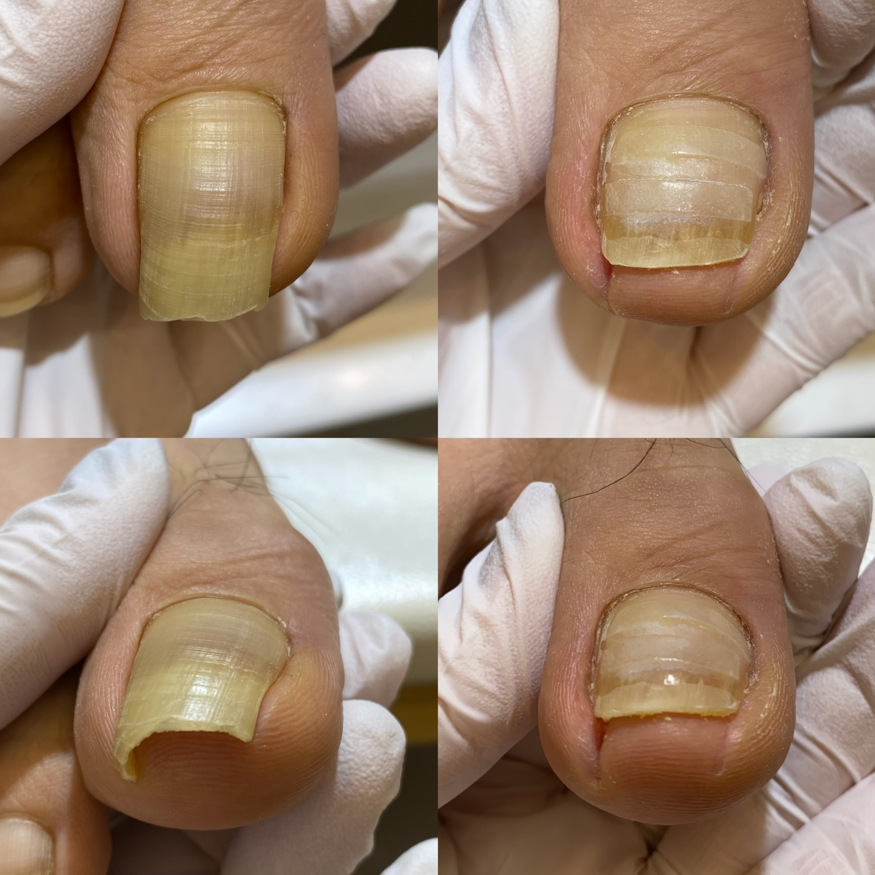 모모뷰티&발톱전문가 대표 이미지