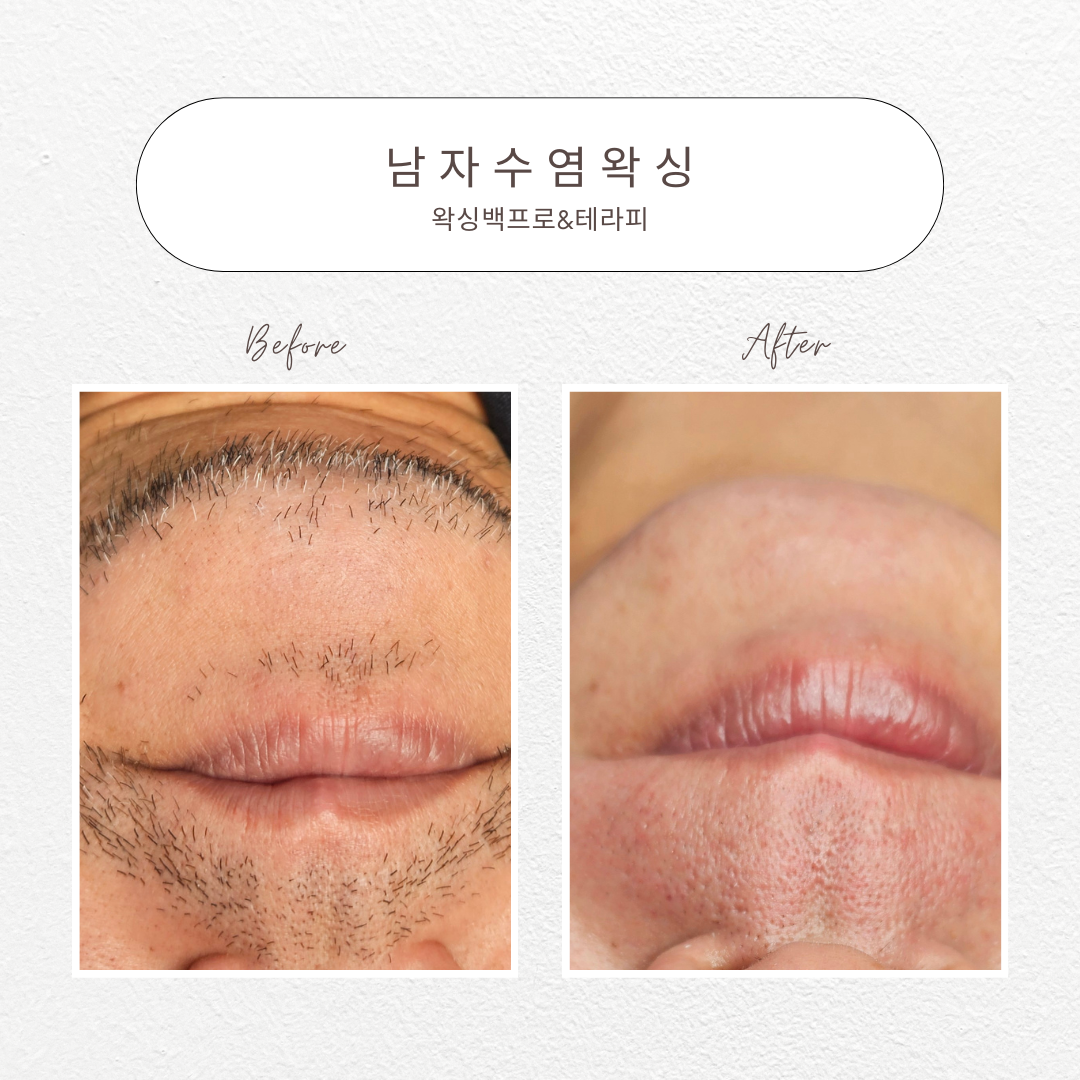 왁싱백프로&테라피