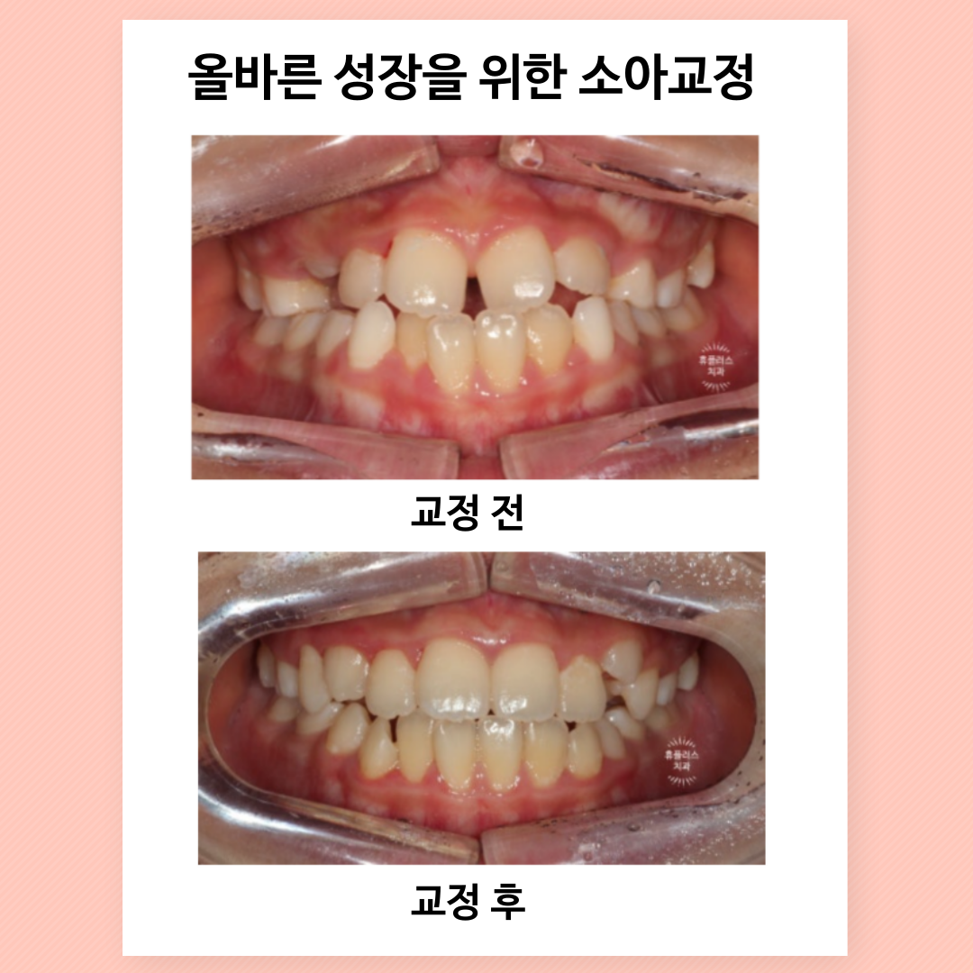 휴플러스치과의원