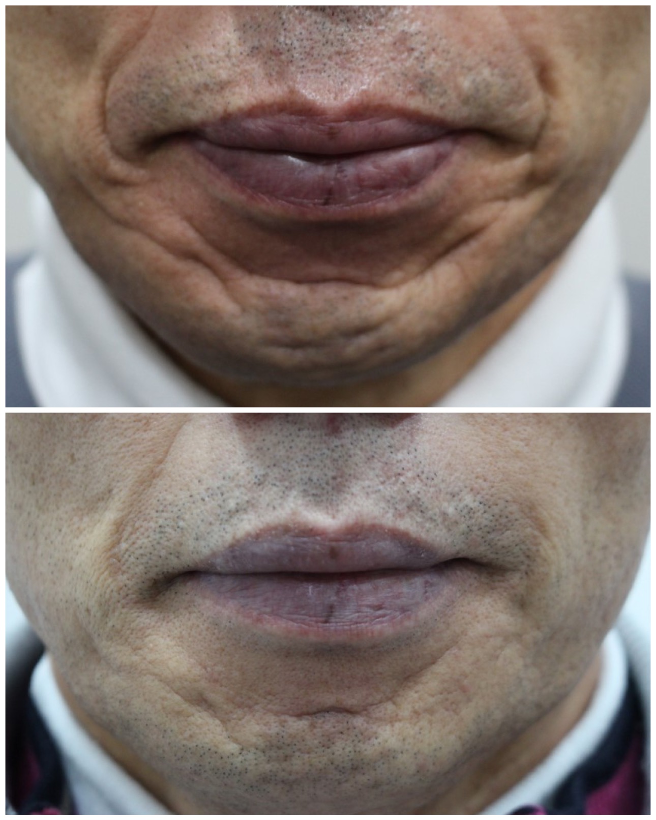 미올린의원 수원본점 대표 이미지