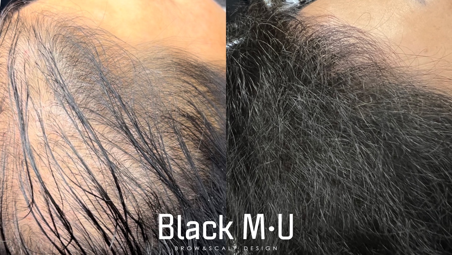 블랙무 대표 이미지