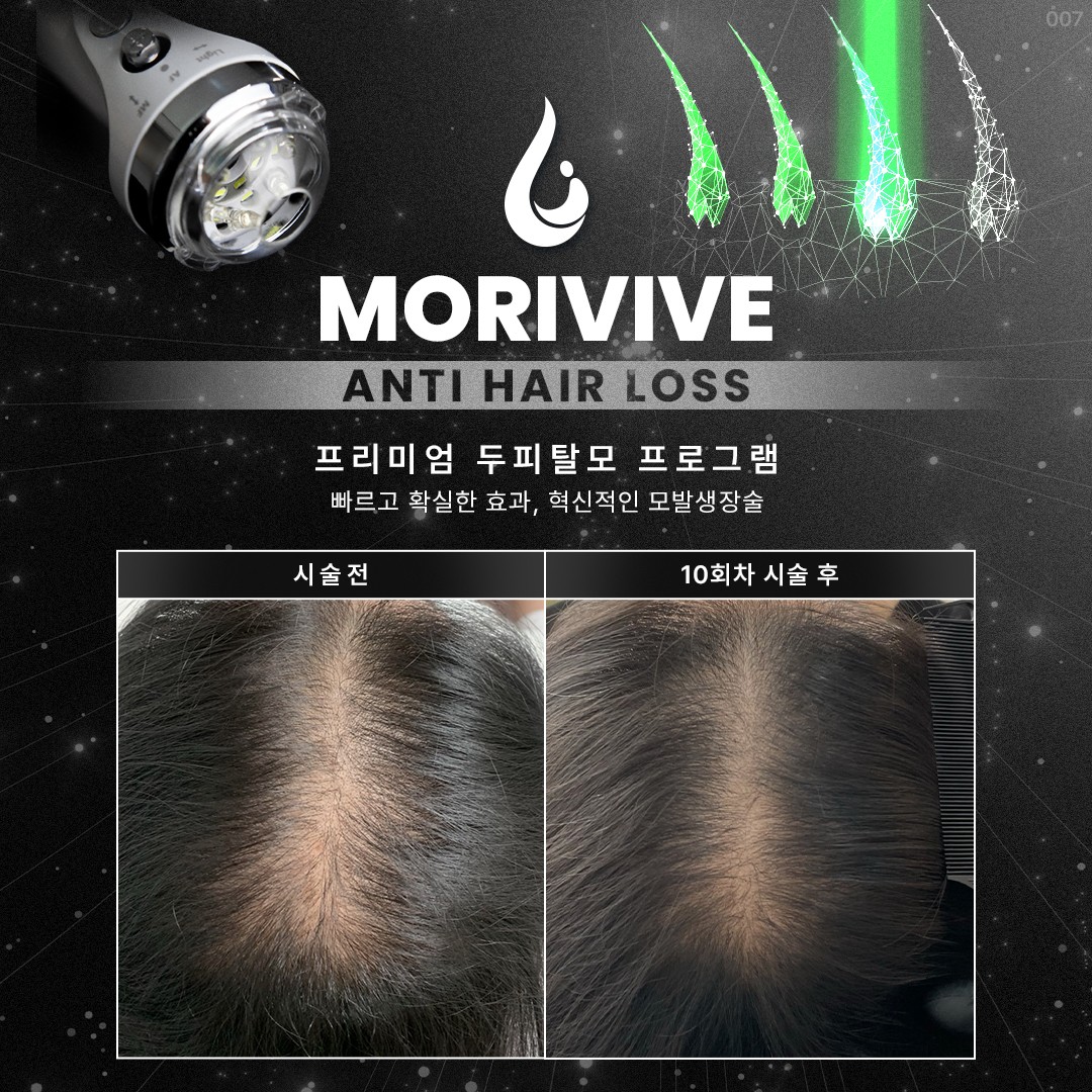 렛미인x모리바이브탈모&두피케어 인천부평점 대표 이미지