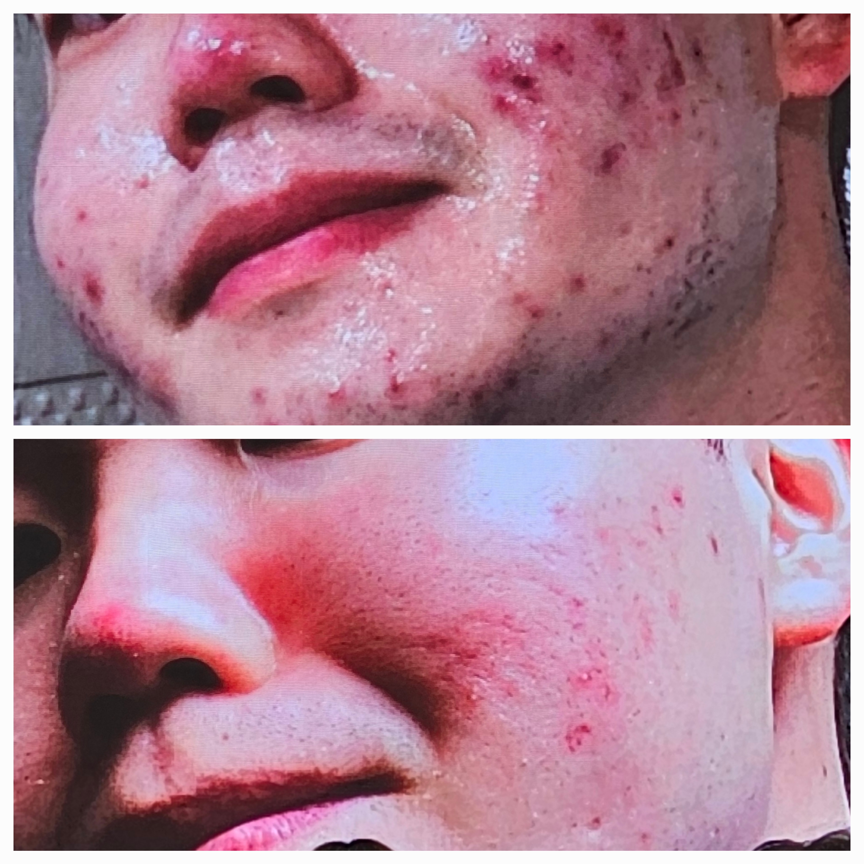 인셀덤 성남일지점