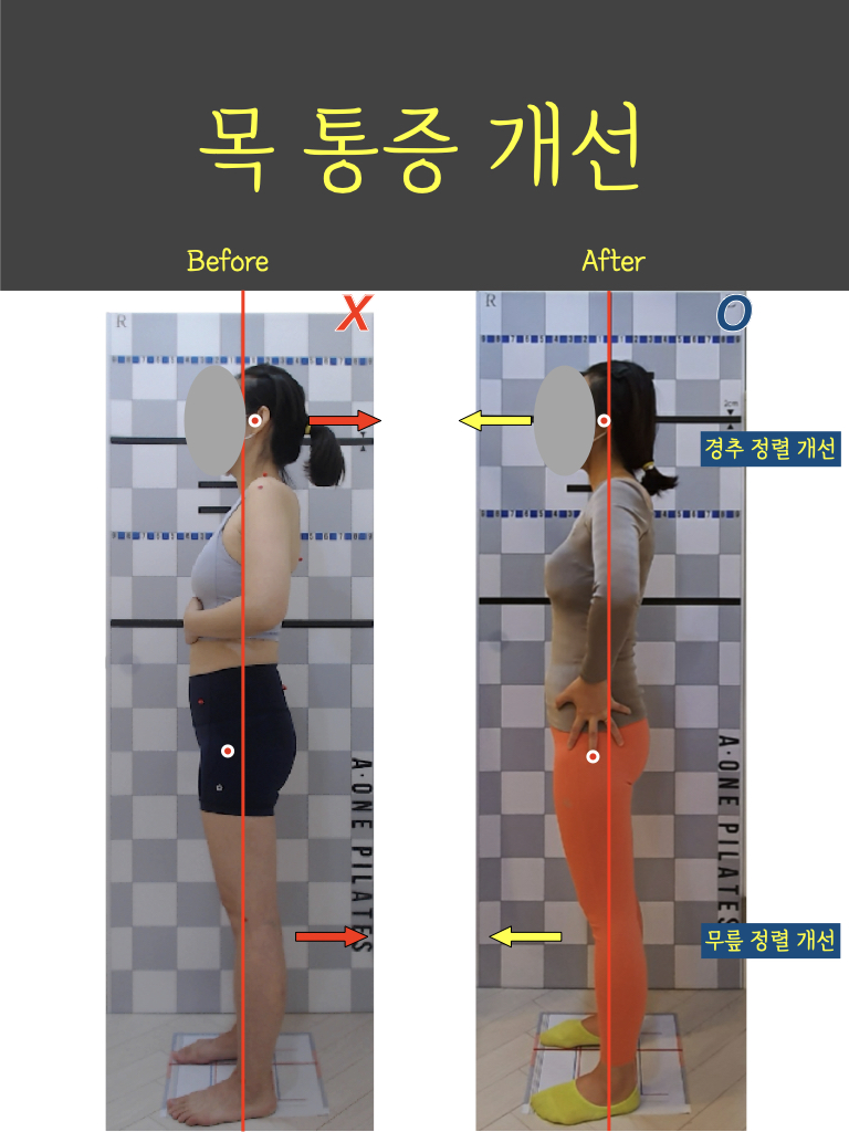 에이원교정운동센터 수원정자점 대표 이미지