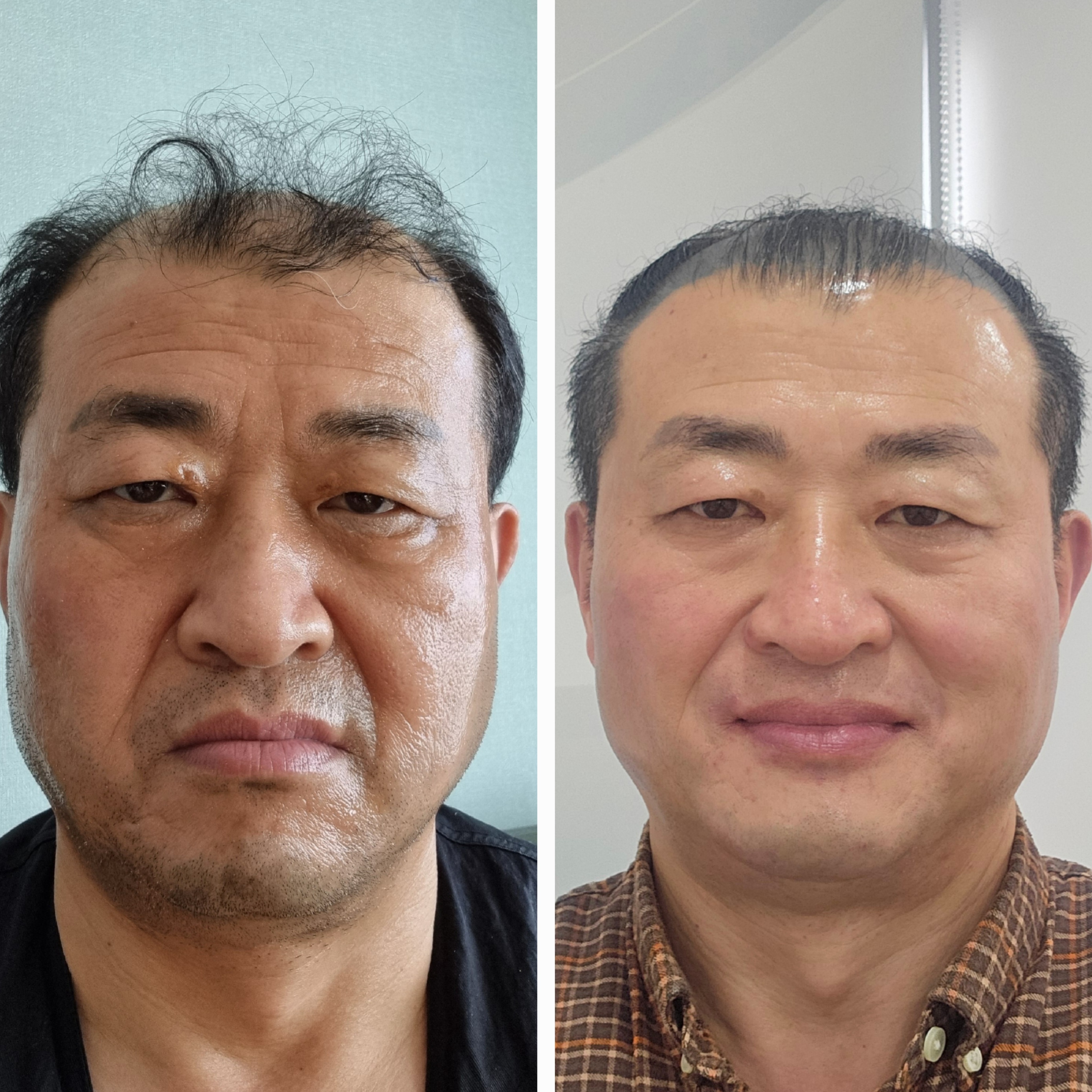 인셀덤 성남일지점