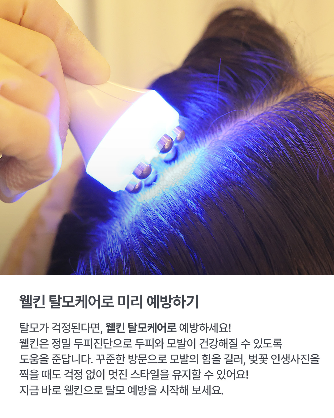 웰킨 두피탈모센터 종로점