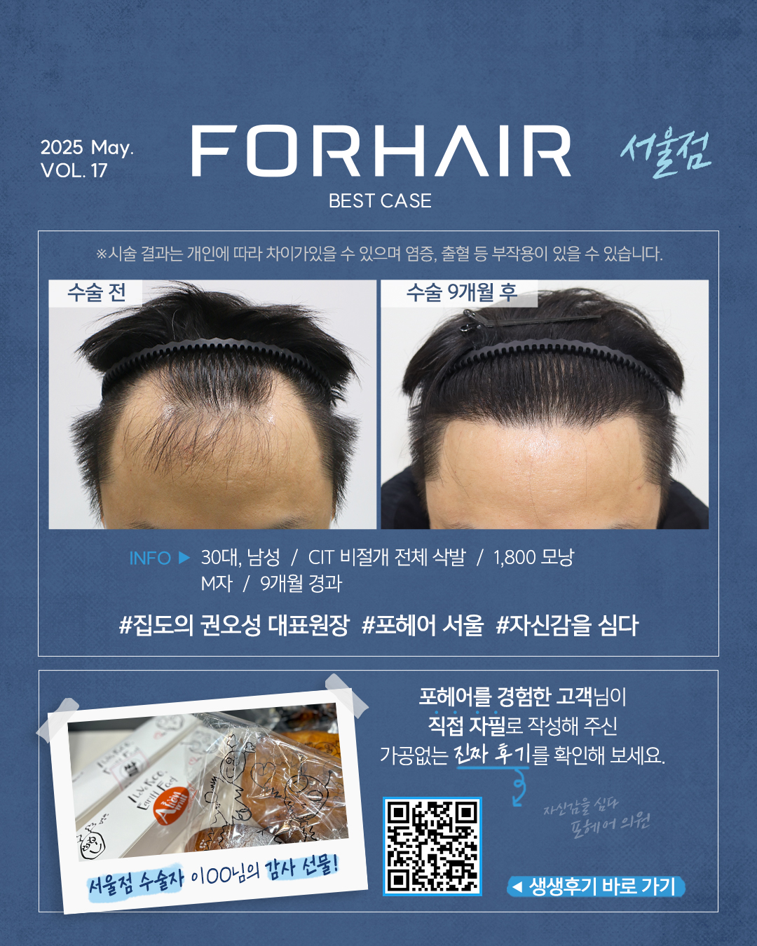 포헤어의원 대표 이미지