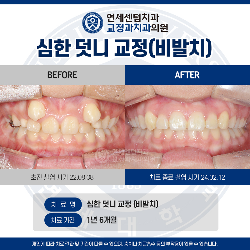 연세센텀치과교정과 대표 이미지